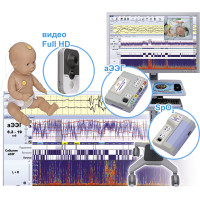 Монитор церебральных функций «Энцефалан-ЦФМ»
