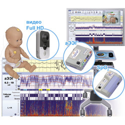 Монитор церебральных функций «Энцефалан-ЦФМ»